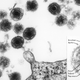 A micrograph of HHV-6, along with a close-up of the virus.